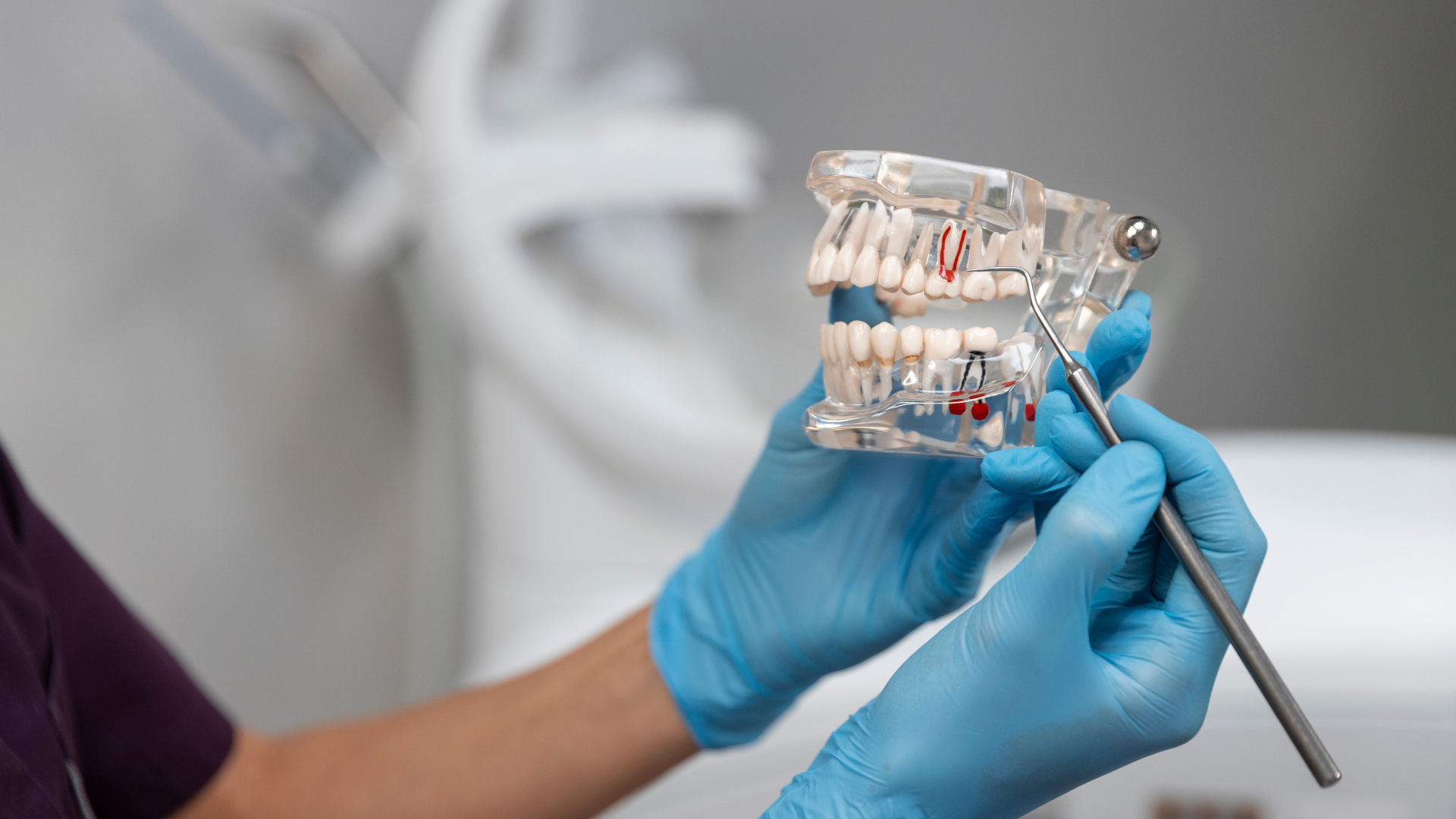 osso_per_inserire_impianti_dentipiu_1