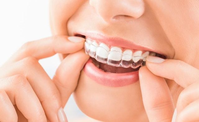 Dentisti a Frosinone Dentipiù Frosinone Il Tuo Studio Dentistico di Fiducia per un Sorriso Perfetto.jpg