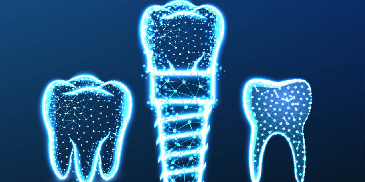 Prezzi impianti dentali 2026: Quanto costa un impianto in Italia e nel mondo